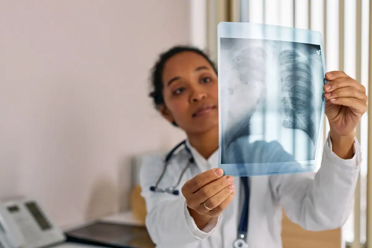 Medic care examinează o radiografie pulmonară ținută în lumină, într-un cabinet modern