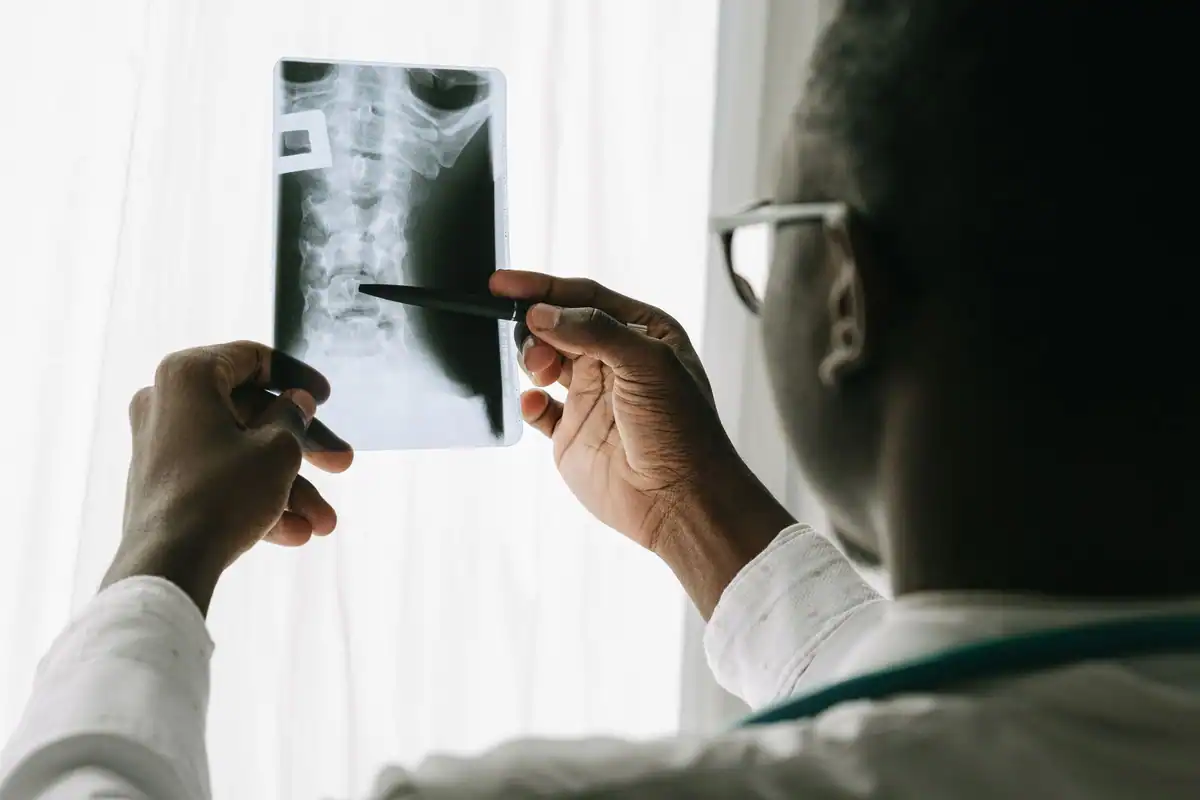 Medic privește în lumină o radiografie a coloanei vertebrale, ținând un pix în mână