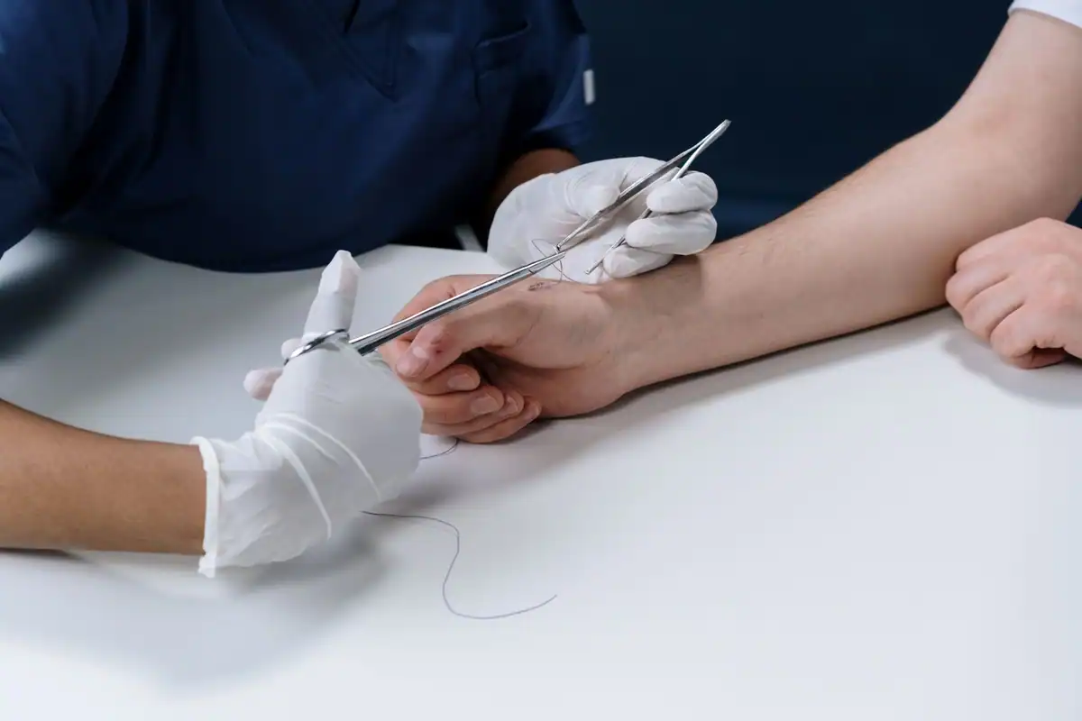 Medic cu mănuși sterile suturează o rană pe brațul unui pacient