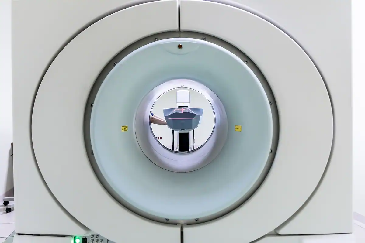 Aparat RMN văzut din față, cu deschiderea circulară spre masa pacientului