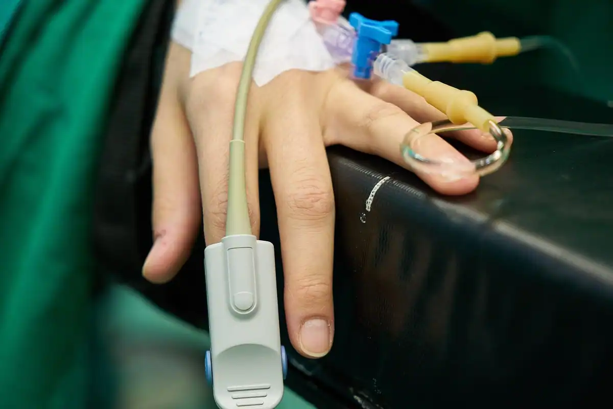 Deget cu senzor de puls, lângă o branulă pentru perfuzie, în timpul sedării